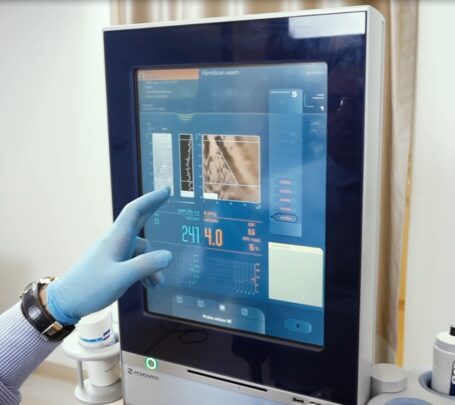 fibroscan nedir faydalari nelerdir2